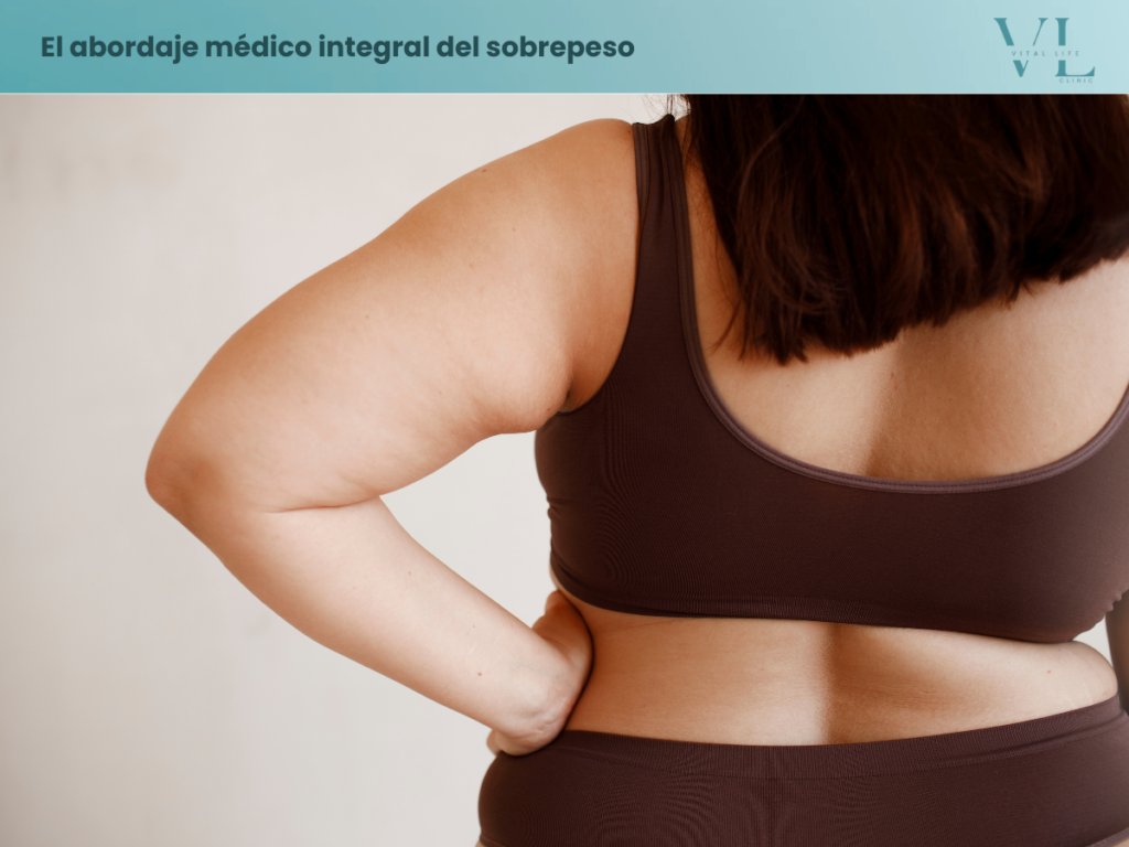 sobrepeso causas y tratamiento médico integral
